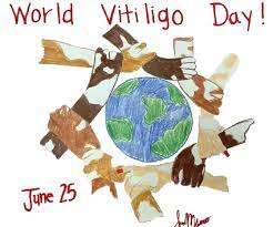 WORLD VITILIGO DAY JUNE 25, 2023